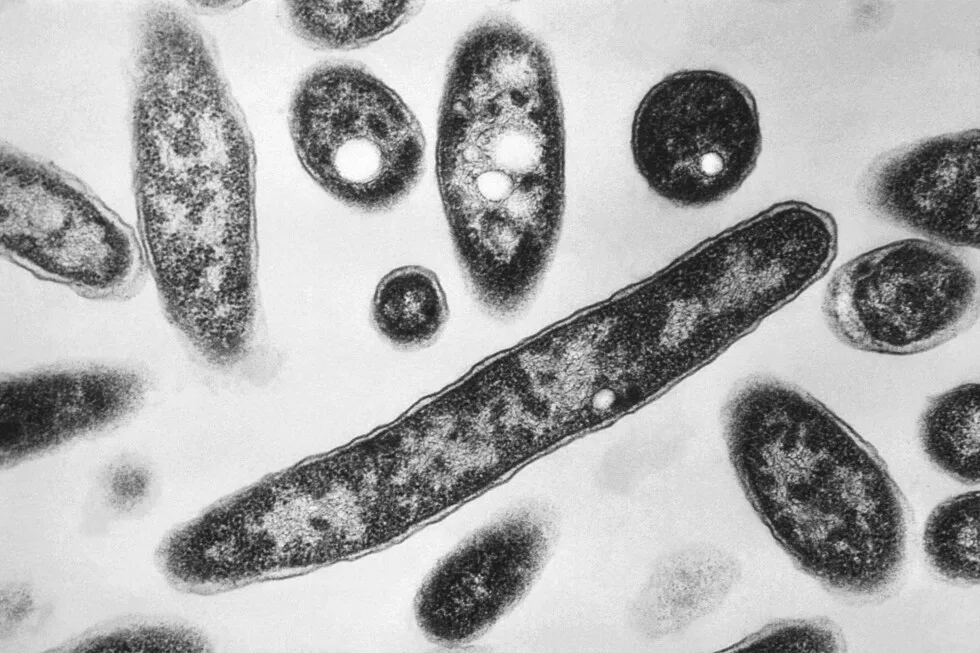 What to know about a Legionnaires' cluster in New York